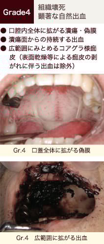 stomatitis_08.jpg stomatitis_08.jpg